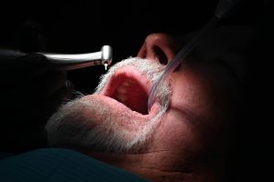 Diş Eti Kanaması ve Çekilmesi Alzheimer Riskini %61 Artırıyor